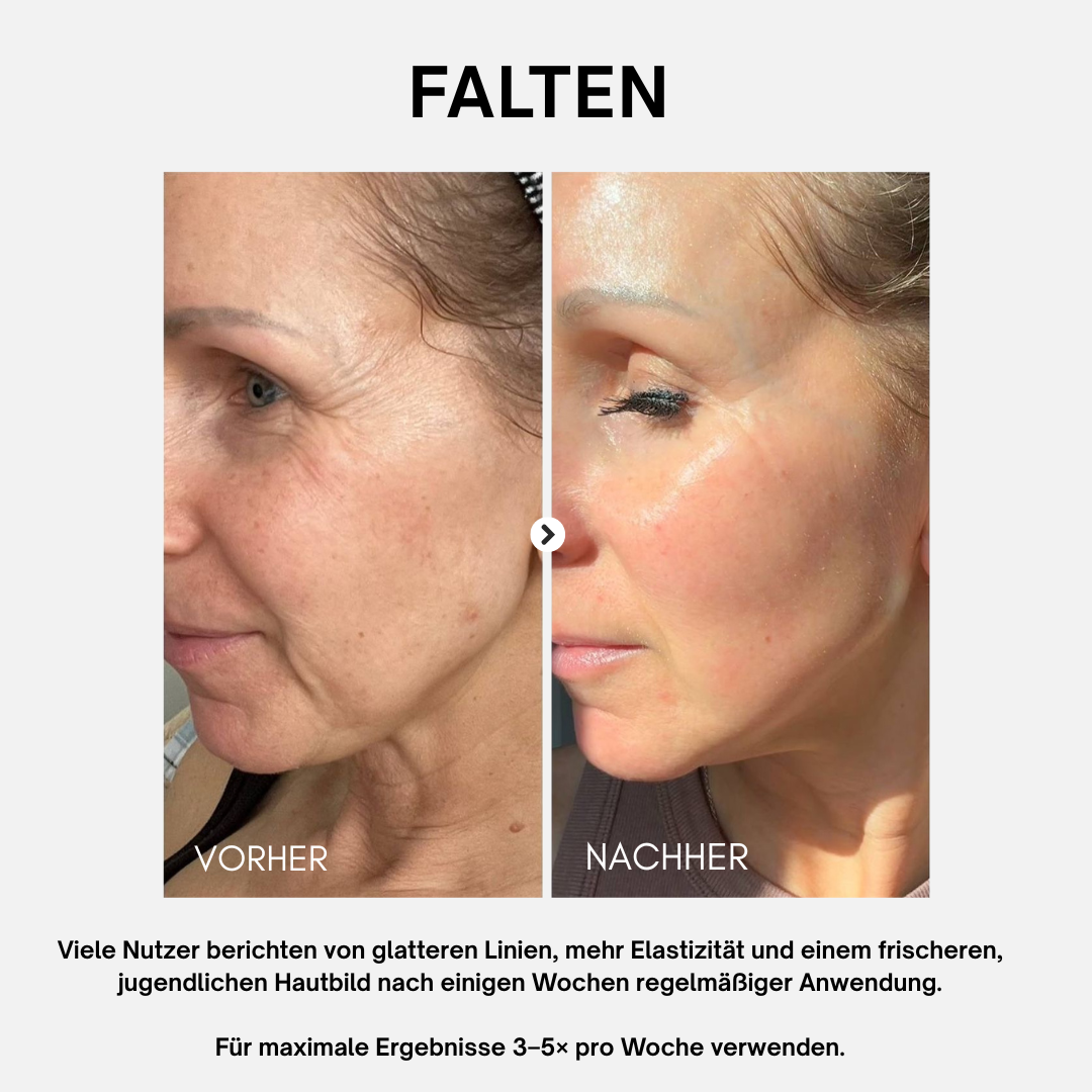 LightPlasma LED Therapie Gesichtsmaske