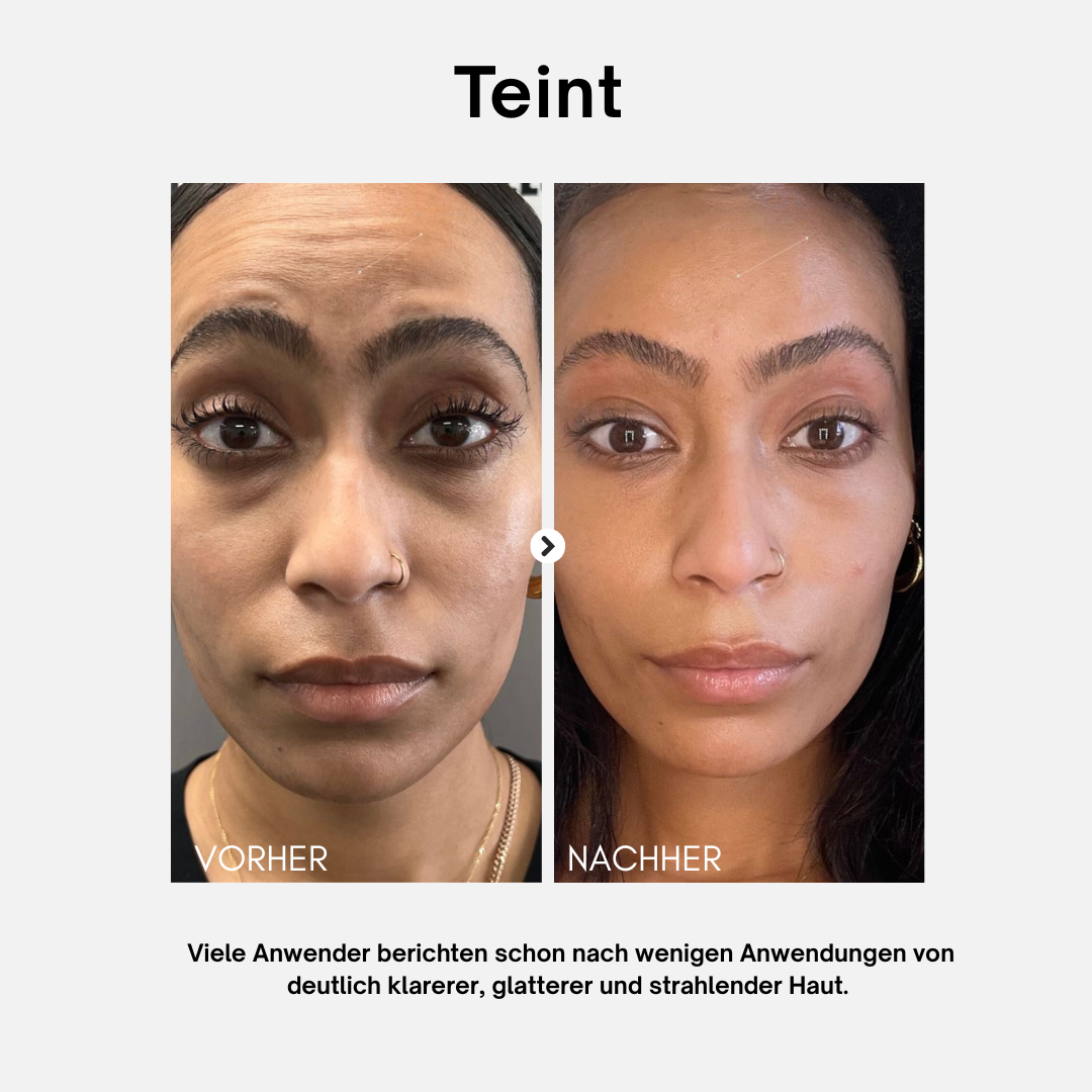 LightPlasma LED Therapie Gesichtsmaske